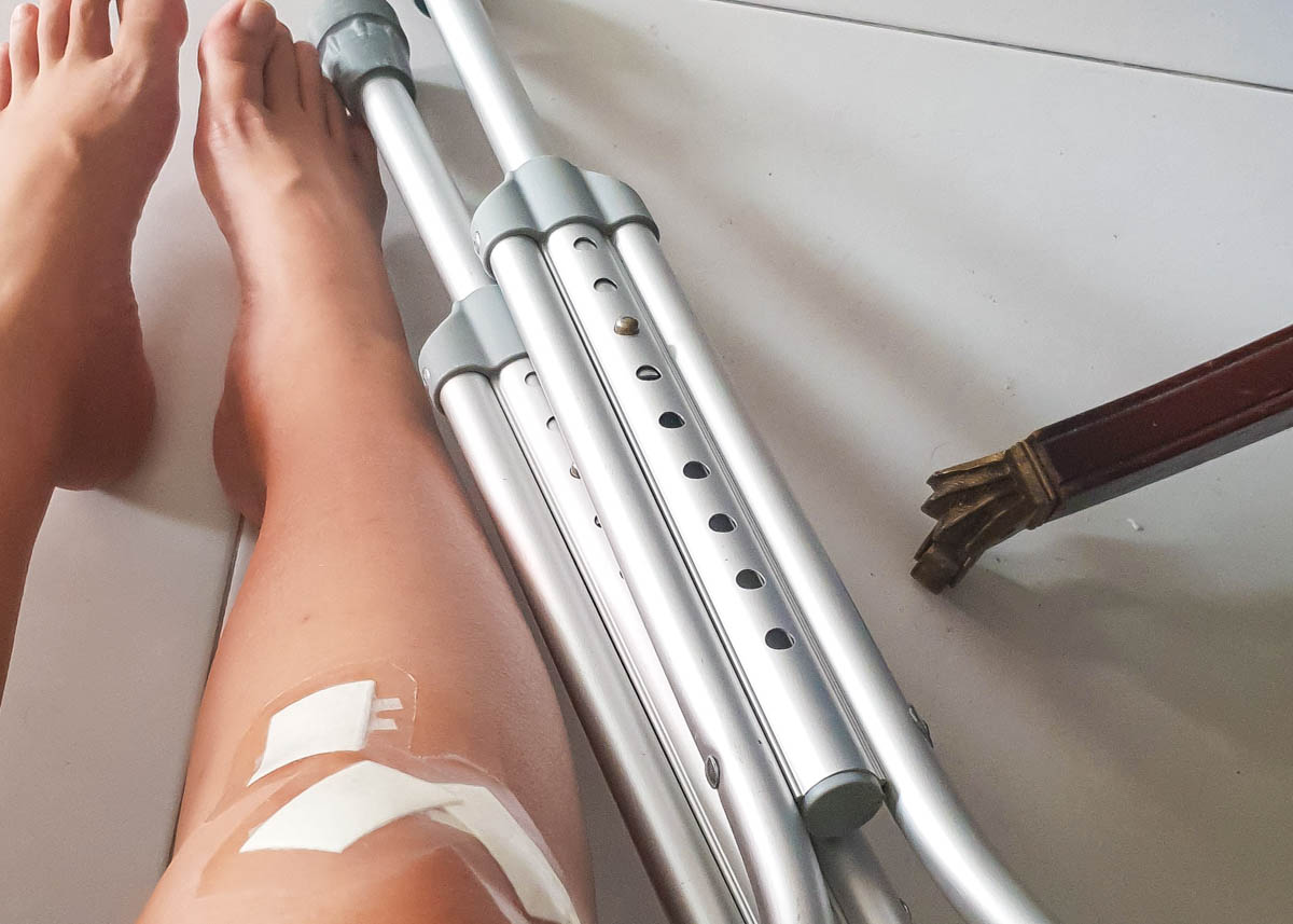 Injured leg with crutches - DirectAsia Travel Insurance Review